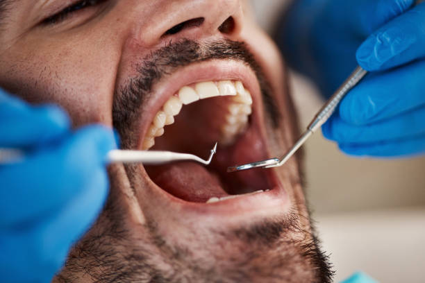Oral Cancer Screening in Tripoli, IA